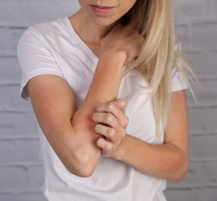 Eczema Treatments 1 real results medical aesthetics eczema | Eczema Treatments