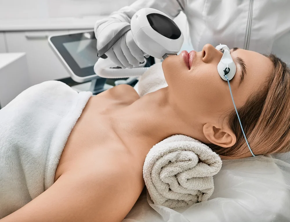 IPL Laser Treatment 1 real results medical aesthetics ipl laser | IPL Laser Treatment