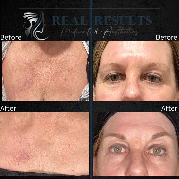 Results 30 Real Results Medical & Aesthetics Opus A