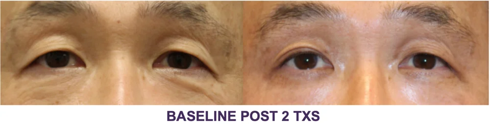 Results 41 Real Results Medical & Aesthetics Opus Before After A