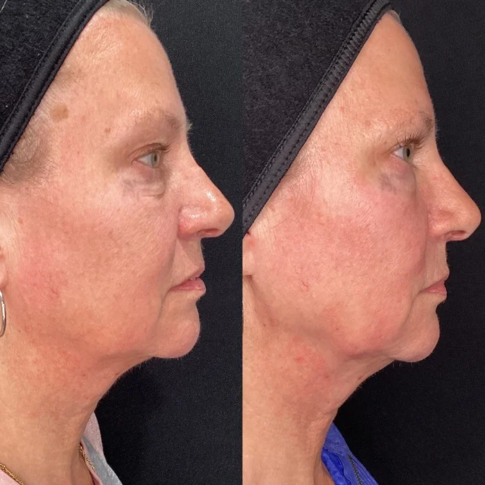 Results 37 Real Results Medical & Aesthetics Opus Before After H
