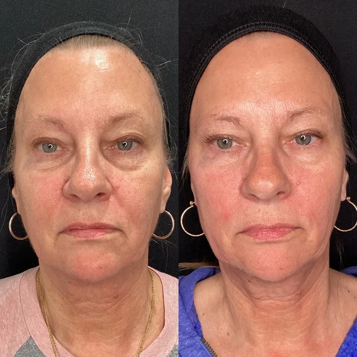 Results 34 Real Results Medical & Aesthetics Opus Before After I