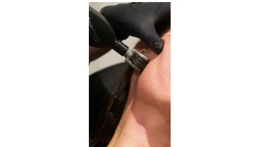 real results medical aesthetics opus services | Services