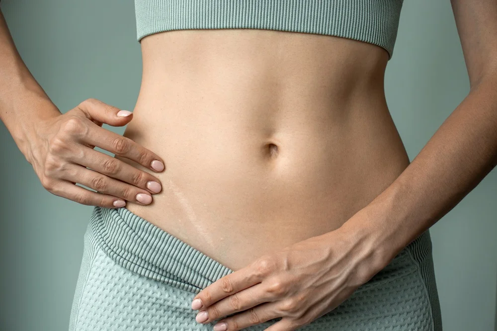 Scar Treatments 1 real results medical aesthetics scars | Scar Treatments