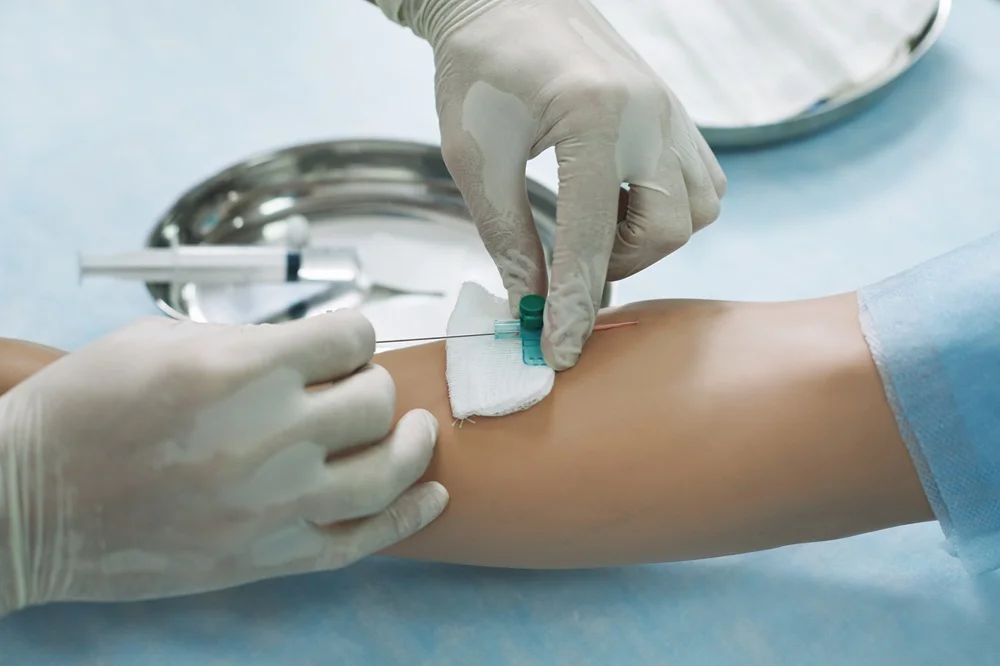 Therapeutic Phlebotomy 1 real results medical aesthetics therapeutic phlebotomy | Therapeutic Phlebotomy