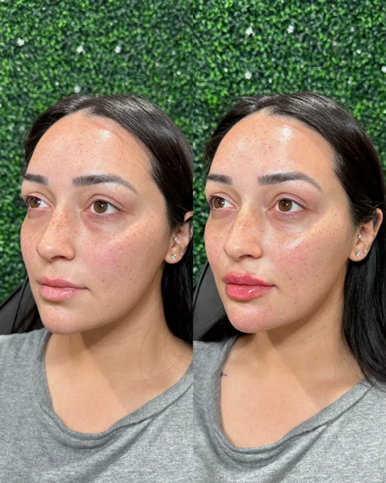 Results 22 Real Results Medical & Aesthetics Injectables A