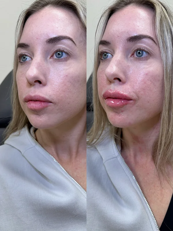 Results 21 Real Results Medical & Aesthetics Injectables B