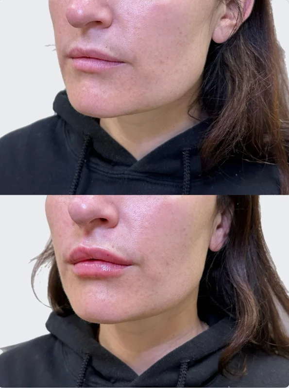 Results 18 Real Results Medical & Aesthetics Injectables C