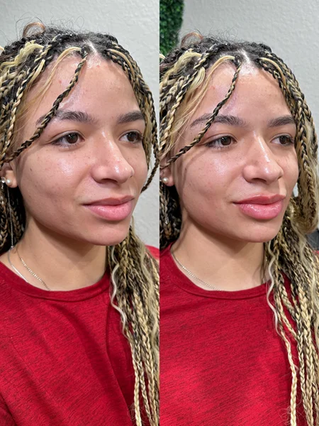 Results 20 Real Results Medical & Aesthetics Injectables D