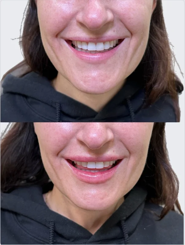Results 19 Real Results Medical & Aesthetics Injectables E