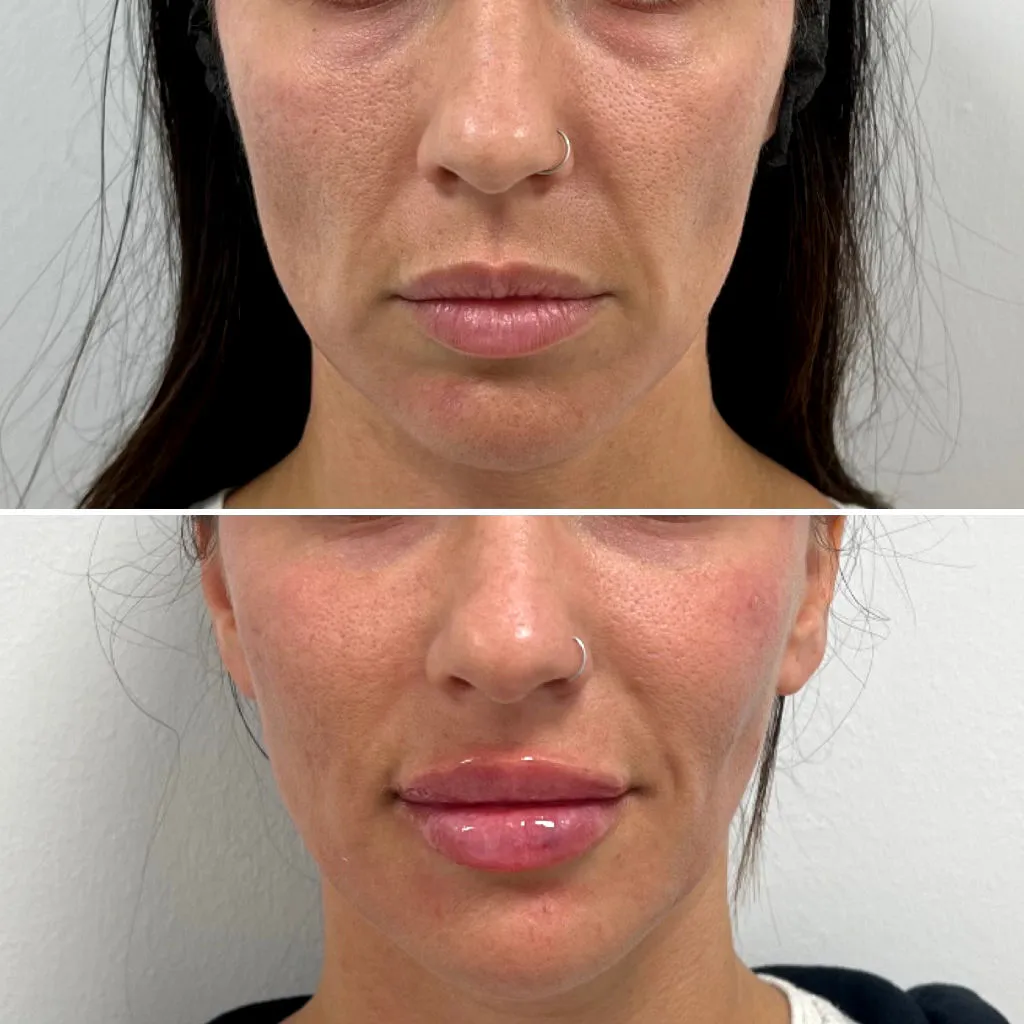 Results 15 Real Results Medical & Aesthetics Injectables F