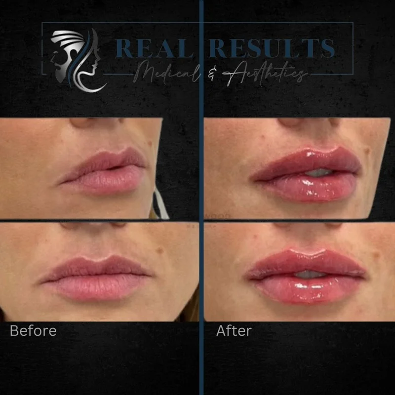 Results 14 Real Results Medical & Aesthetics Injectables G