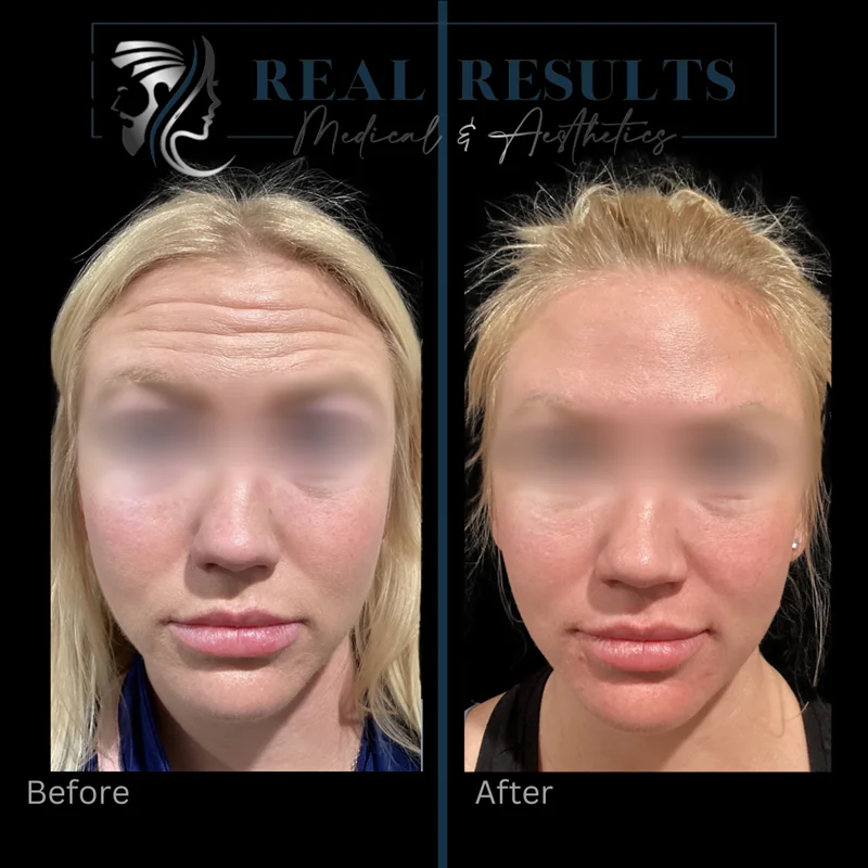Results 16 Real Results Medical & Aesthetics Injectables H