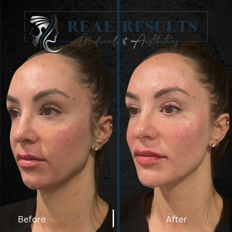 Results 17 Real Results Medical & Aesthetics Injectables I
