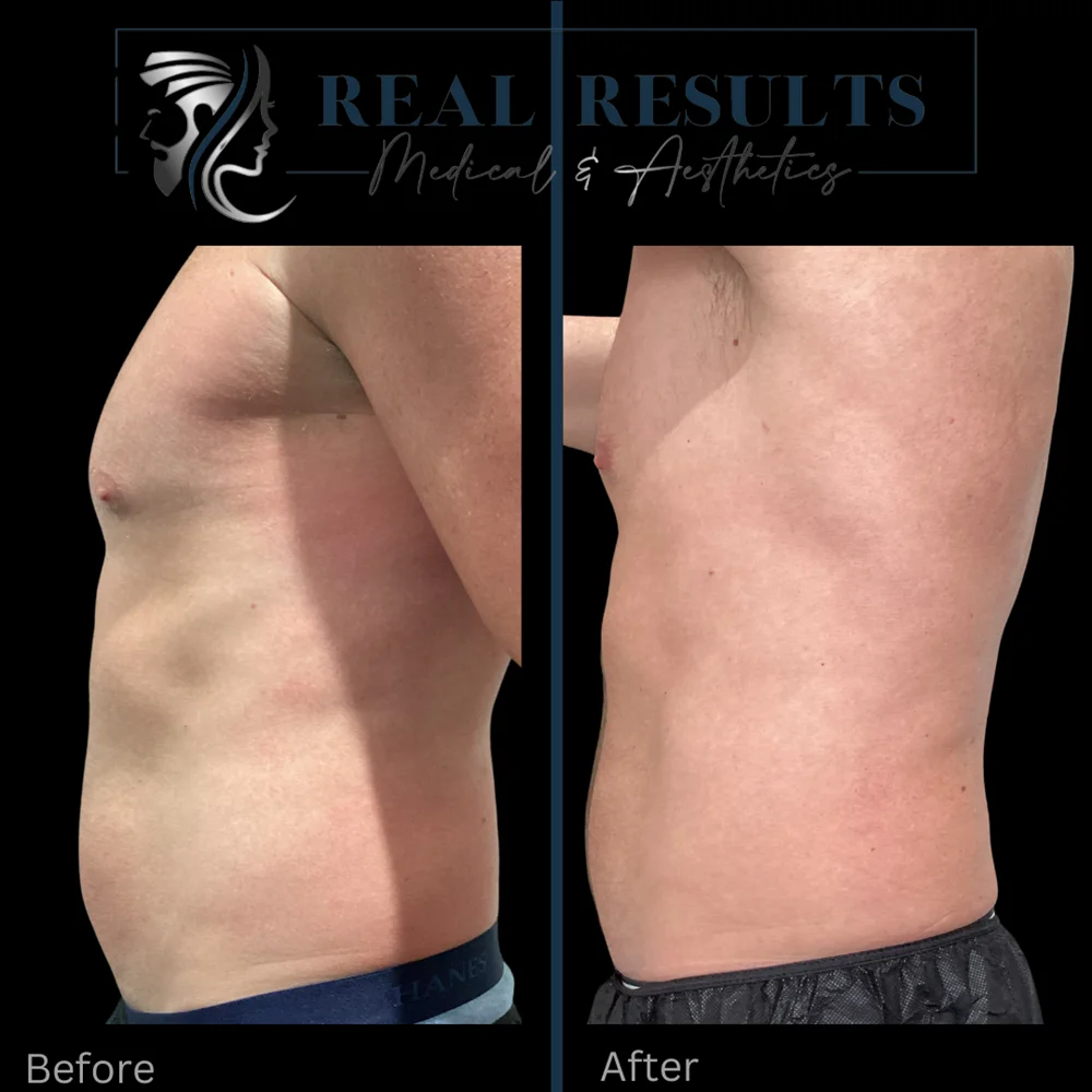 Results 9 Real Results Medical & Aesthetics Injectables K