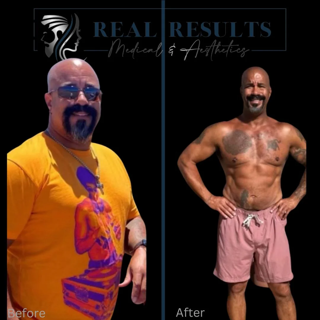 Results 43 Real Results Medical & Aesthetics Peptide one
