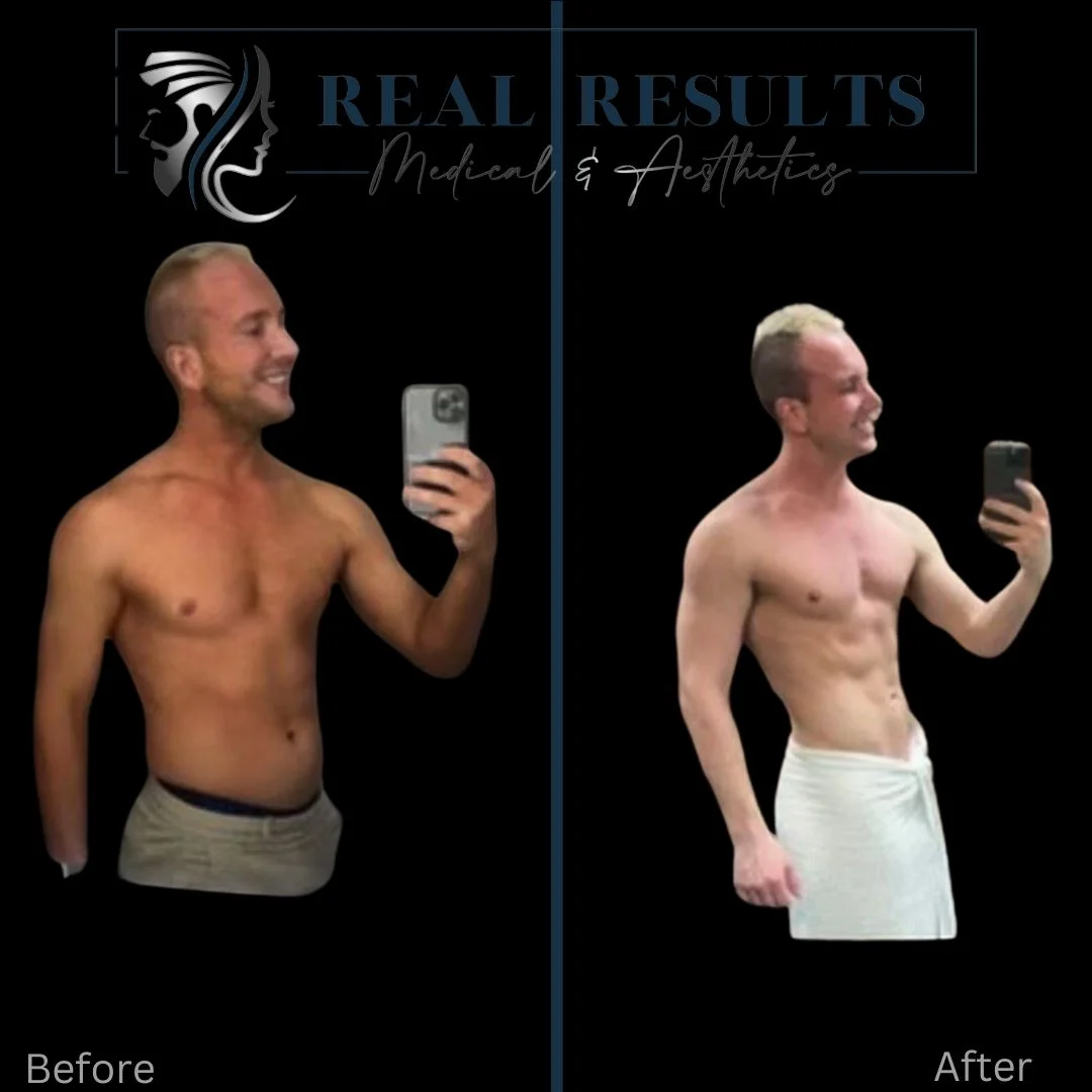 Results 58 Real Results Medical & Aesthetics Weight Loss Five