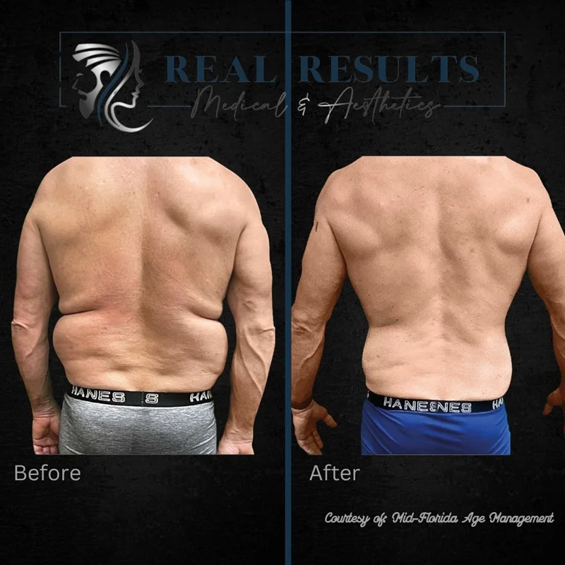 Results 57 Real Results Medical & Aesthetics Weight Loss Four