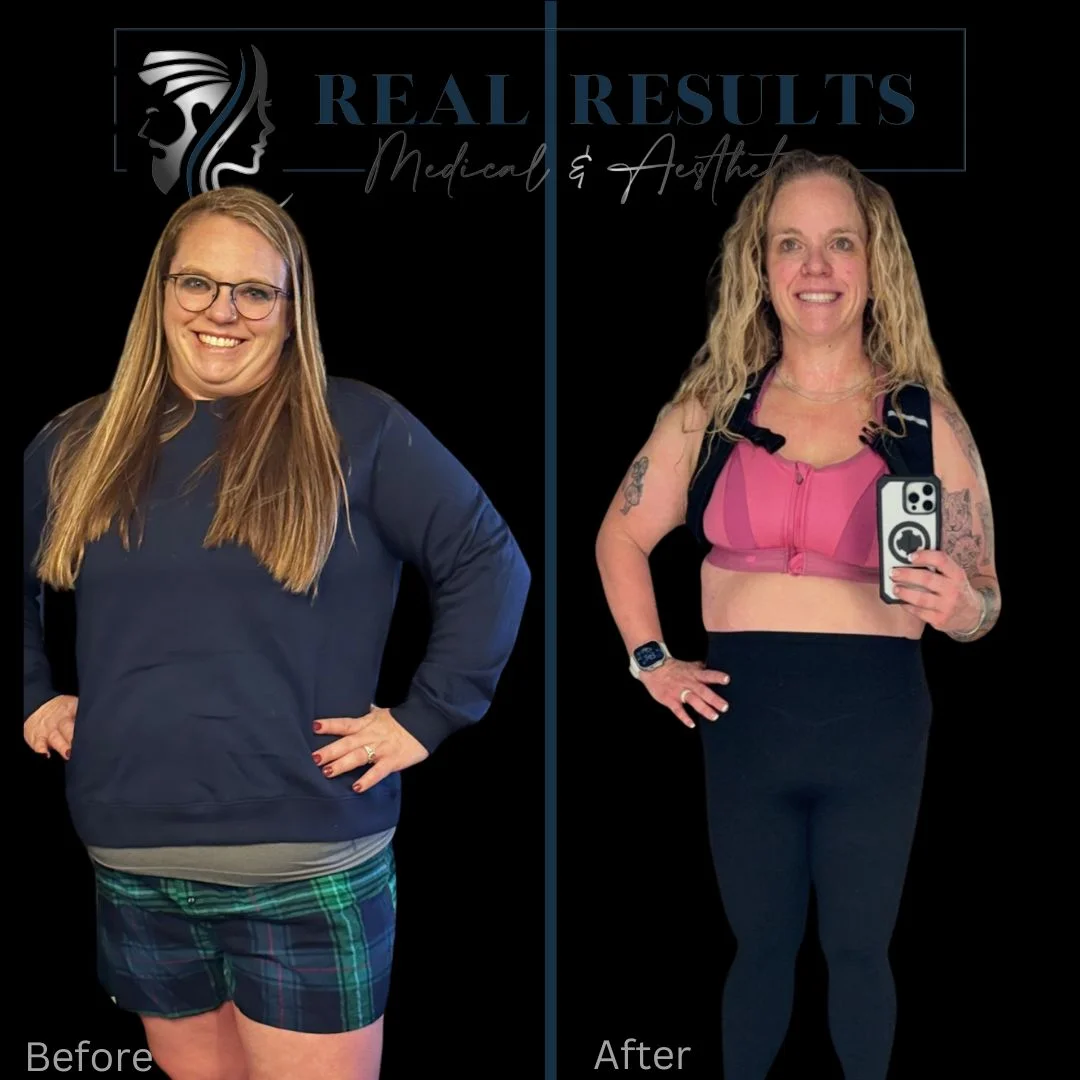 Results 60 Real Results Medical & Aesthetics Weight Loss Seven