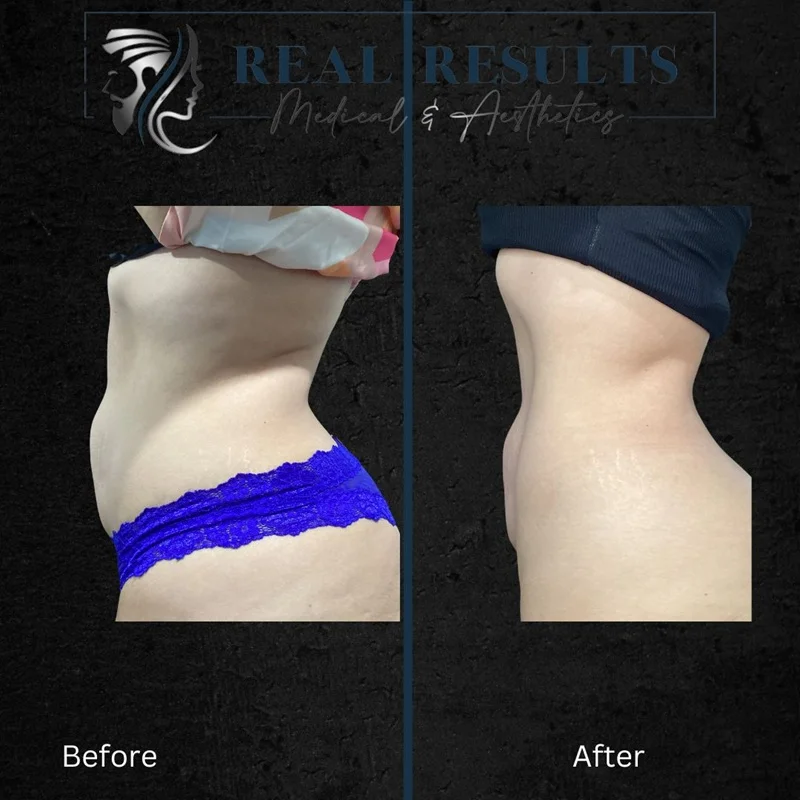 Results 59 Real Results Medical & Aesthetics Weight Loss Six