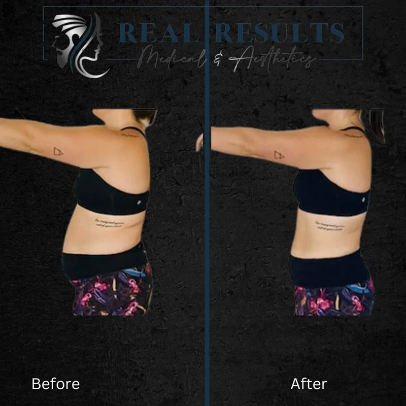 Results 56 Real Results Medical & Aesthetics Weight Loss three