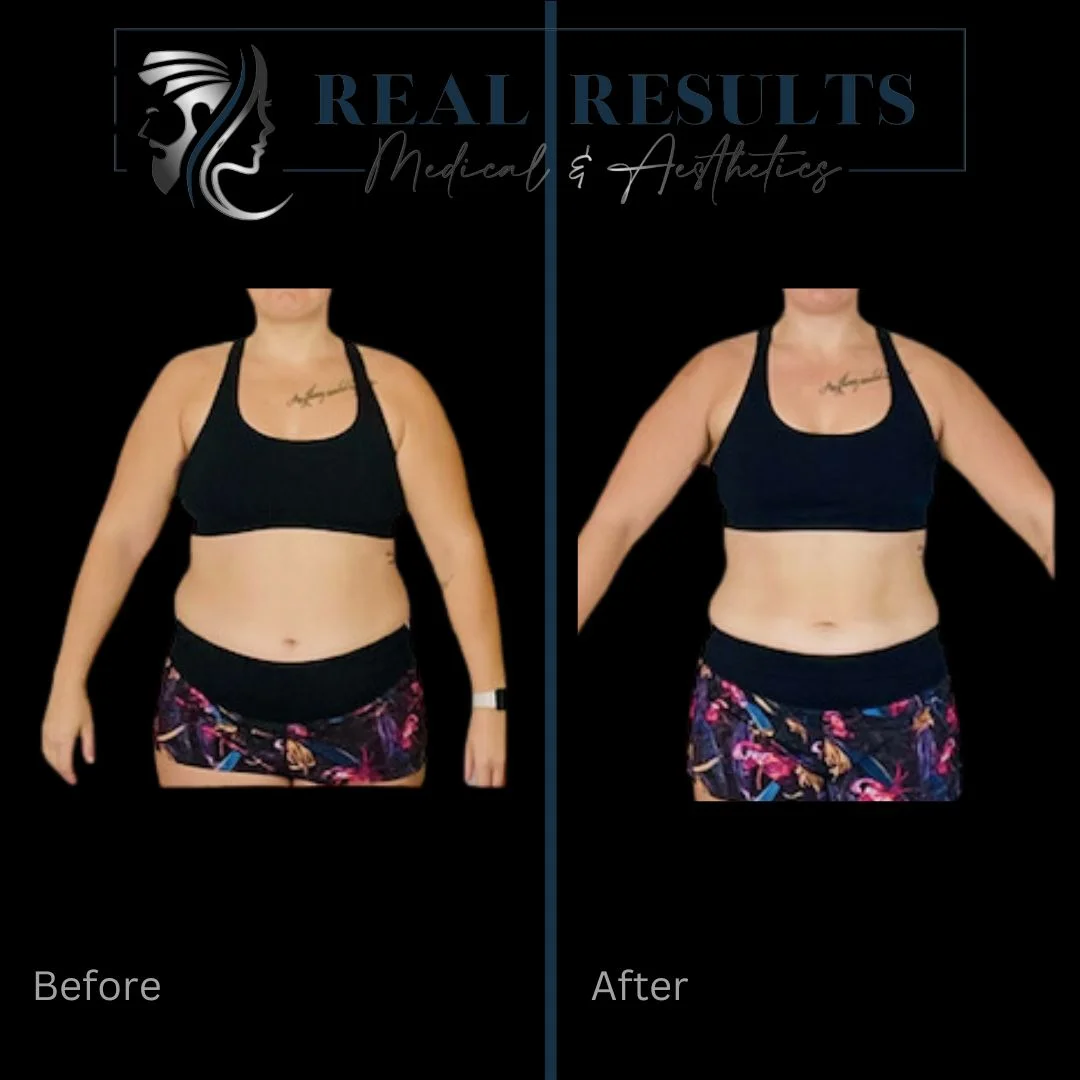 Results 55 Real Results Medical & Aesthetics Weight Loss Two