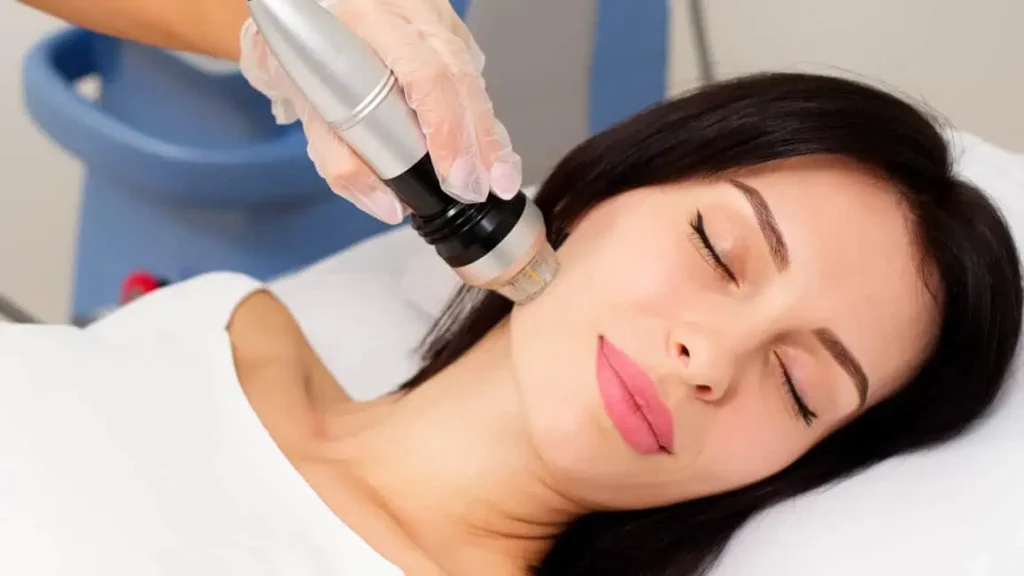 Skin Resurfacing by Real results medical & aesthetics in Scottsdale, AZ