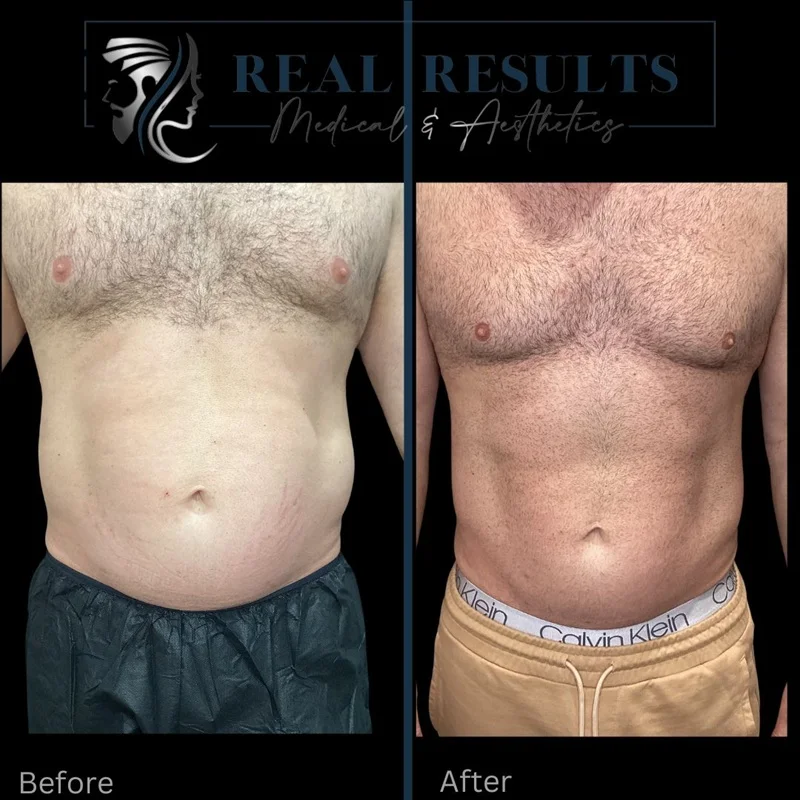 Real Results Medical & Aesthetics Injectables J