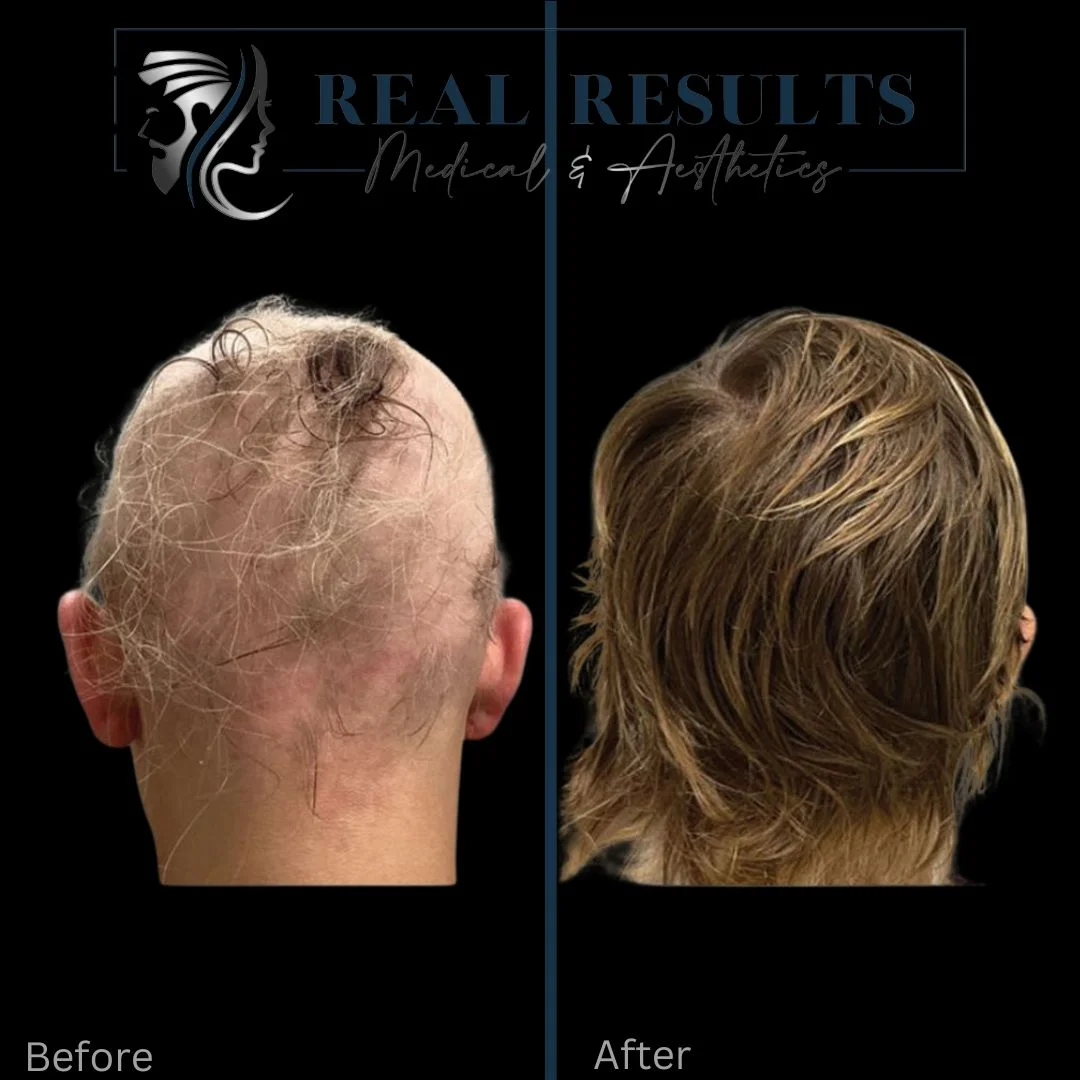 Real Results Medical & Aesthetics Ted Nine