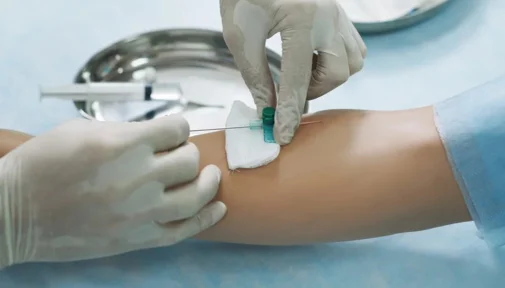 real results medical aesthetics therapeutic phlebotomy services | Services